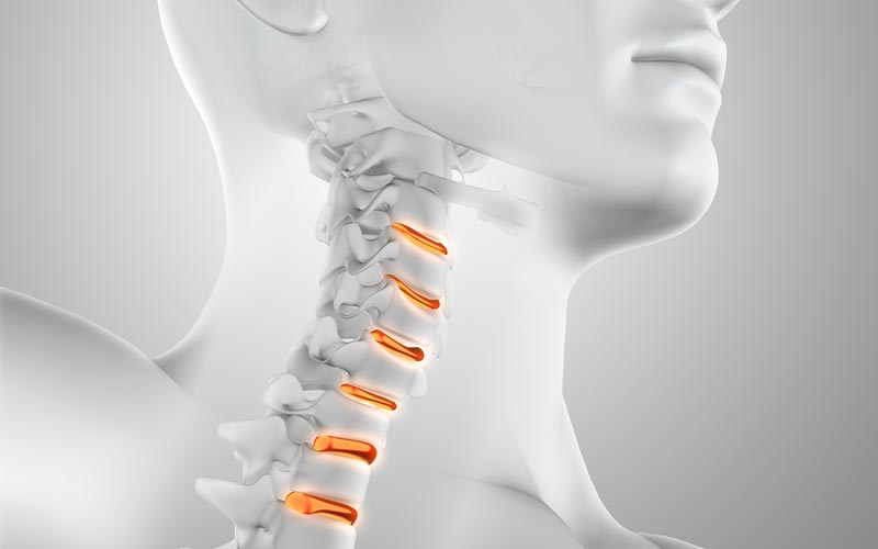 Hive-blog-cervicale.jpg